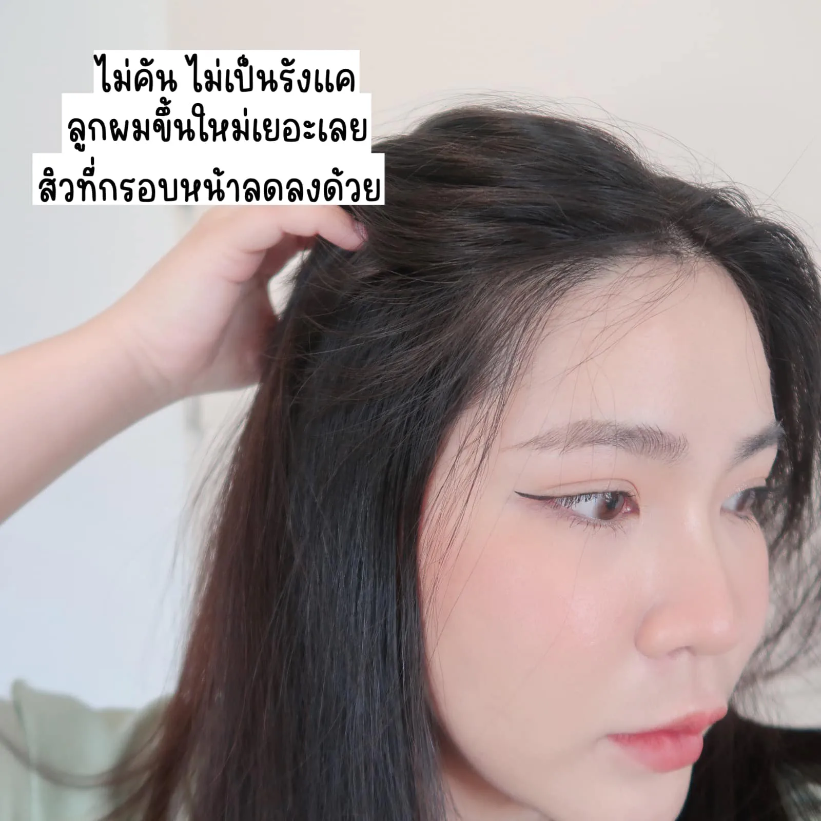 ဦးရေပြားပြဿနာ ကြုံဖူးသူတိုင်း ဘယ်လောက်ယားတယ်ဆိုတာ သိပါတယ်။ ဆံပင်ကျွတ်လျှော့ချမှုနဲ့ နာမည်ကြီးတဲ့ AloEx Extra Mild ကို တွေ့ခဲ့ရတယ်။
