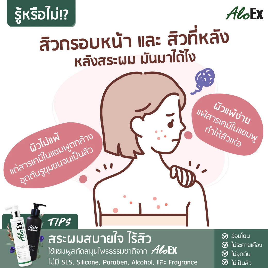 ဆံပင်လျှော်ပြီးနောက် ဆံစပ်နားနှင့် ကျောပြင်တွင် ဝက်ခြံ — ဘယ်ကလာတာလဲ?