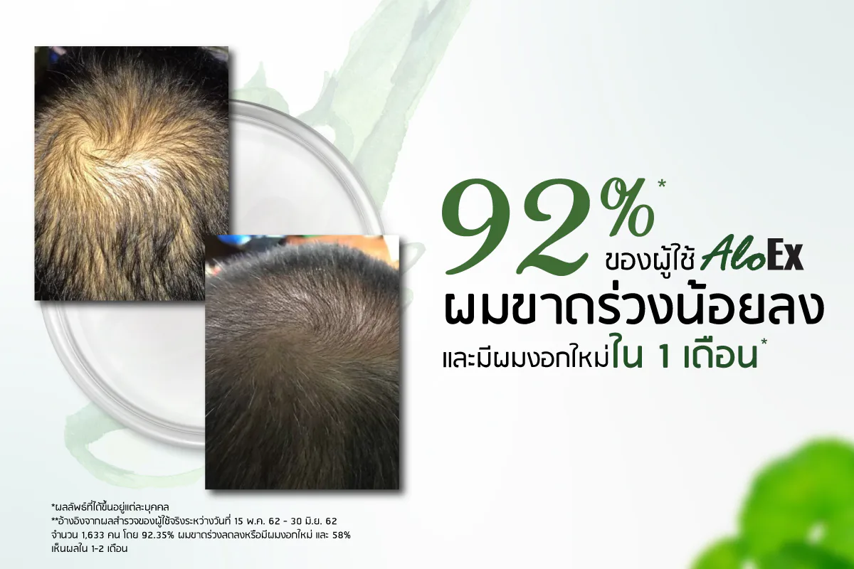 AloEx အသုံးပြုသူ ၈၉% သည် ဆံပင်ကျွတ်ခြင်း လျော့နည်းခြင်း နှင့်/သို့မဟုတ် ဆံပင်အသစ်ပေါက်ခြင်းကို တွေ့ရှိခဲ့သည်