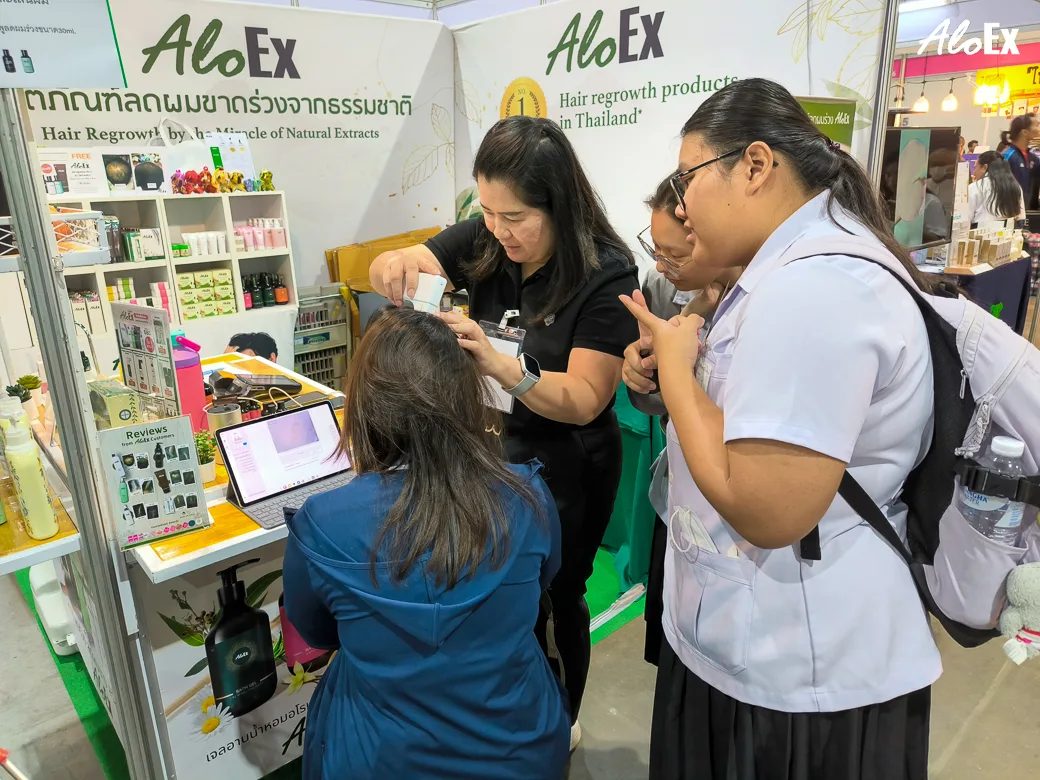 AloEx 专家在 B20 展位提供免费头发与头皮检测咨询