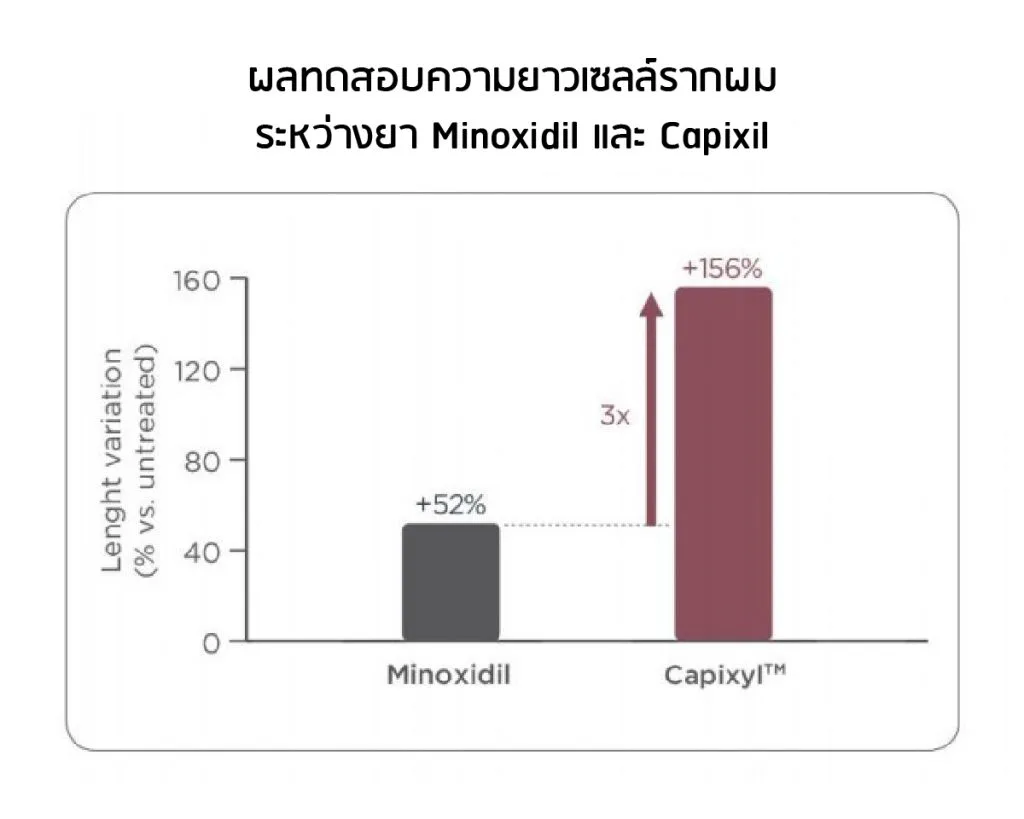 စမ်းသပ်မှုရလဒ်များ — Capixyl နှင့် Minoxidil နှိုင်းယှဉ်ချက်