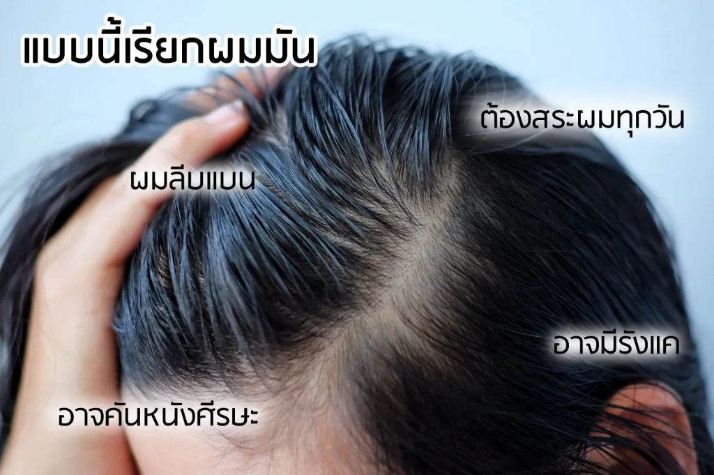 AloEx แชมพูสำหรับผมมัน