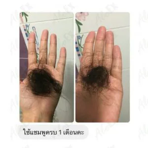 รีวิวก่อนใช้-หลังใช้ แชมพู AloEx