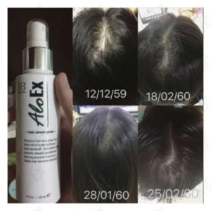 รีวิวก่อนใช้-หลังใช้ เซรั่ม AloEx