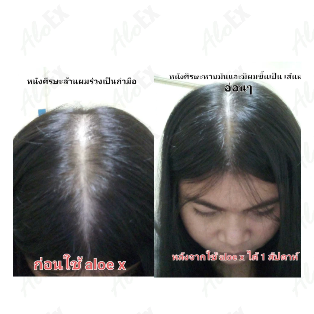 รีวิวก่อนใช้-หลังใช้ ผลิตภัณฑ์ AloEx