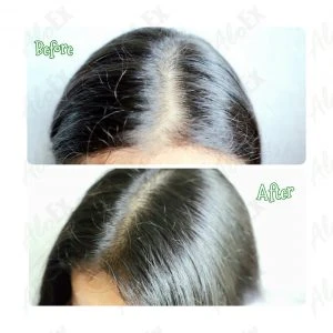 รีวิวก่อนใช้-หลังใช้ ผลิตภัณฑ์ AloEx
