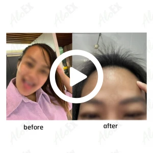 Before & After Reviews — AloEx Products