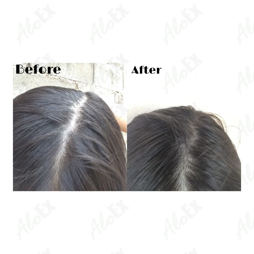 รีวิวก่อนใช้-หลังใช้ เซรั่ม AloEx