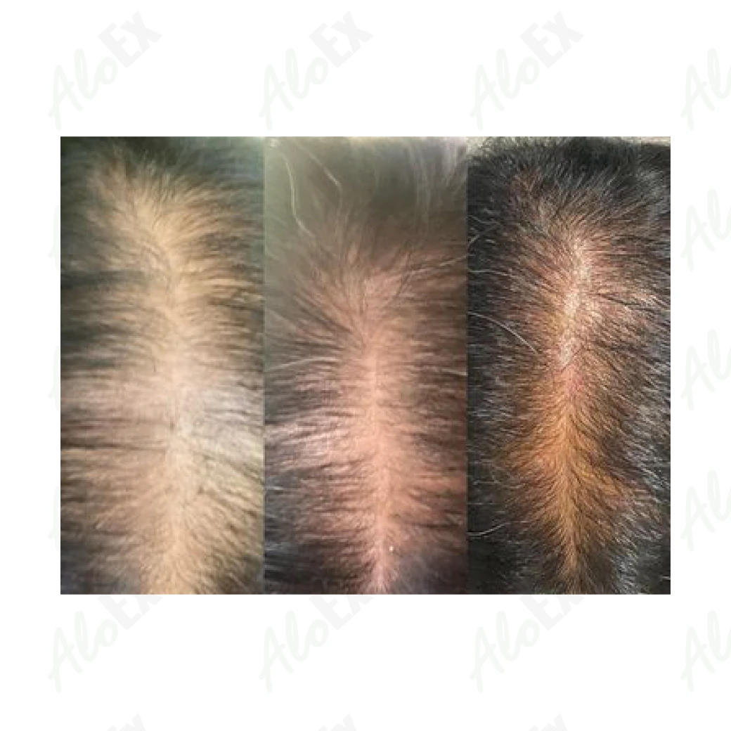 รีวิวก่อนใช้-หลังใช้ ผลิตภัณฑ์ AloEx