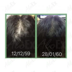 รีวิวก่อนใช้-หลังใช้ ผลิตภัณฑ์ AloEx