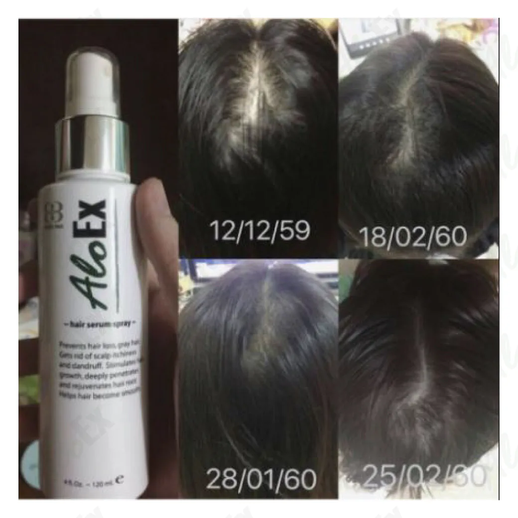 รีวิวก่อนใช้-หลังใช้ ผลิตภัณฑ์ AloEx