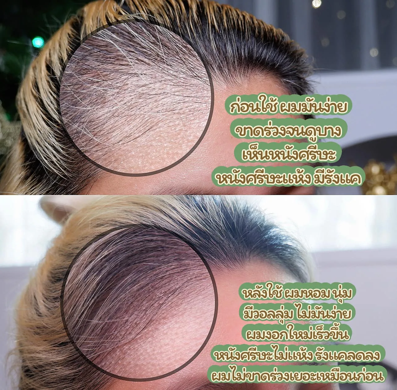 AloEx Extra Mild Natural Hair Regrowth Shampoo สูตรสำหรับคนที่ทีผิวบอบบางแพ้ง่าย ผิวระคายเคืองง่ายเป็นพิเศษ