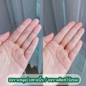ตอนนี้หันมาใช้แชมพูที่ช่วยลดผมร่วง ผมขาดแบบจริงจัง ของ AloEx