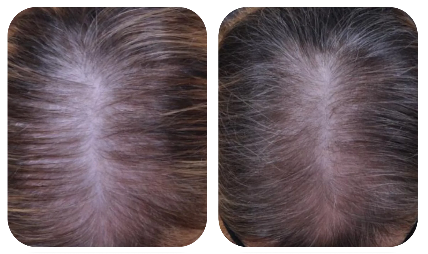 Da đầu trước và sau khi dùng AloEx Organic Intensive Hair Serum, ảnh 1