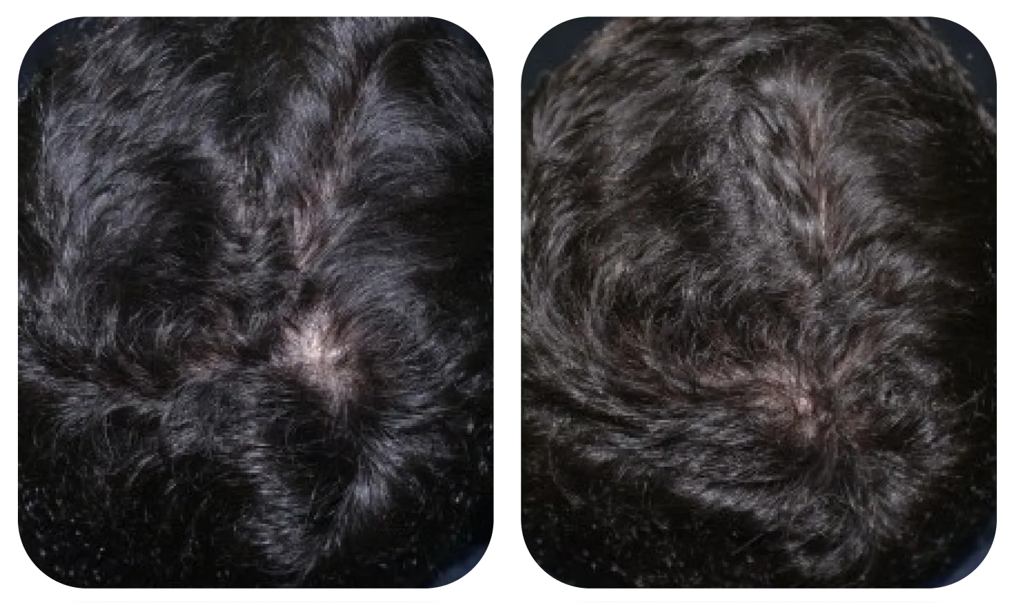 Da đầu trước và sau khi dùng AloEx Organic Intensive Hair Serum, ảnh 3
