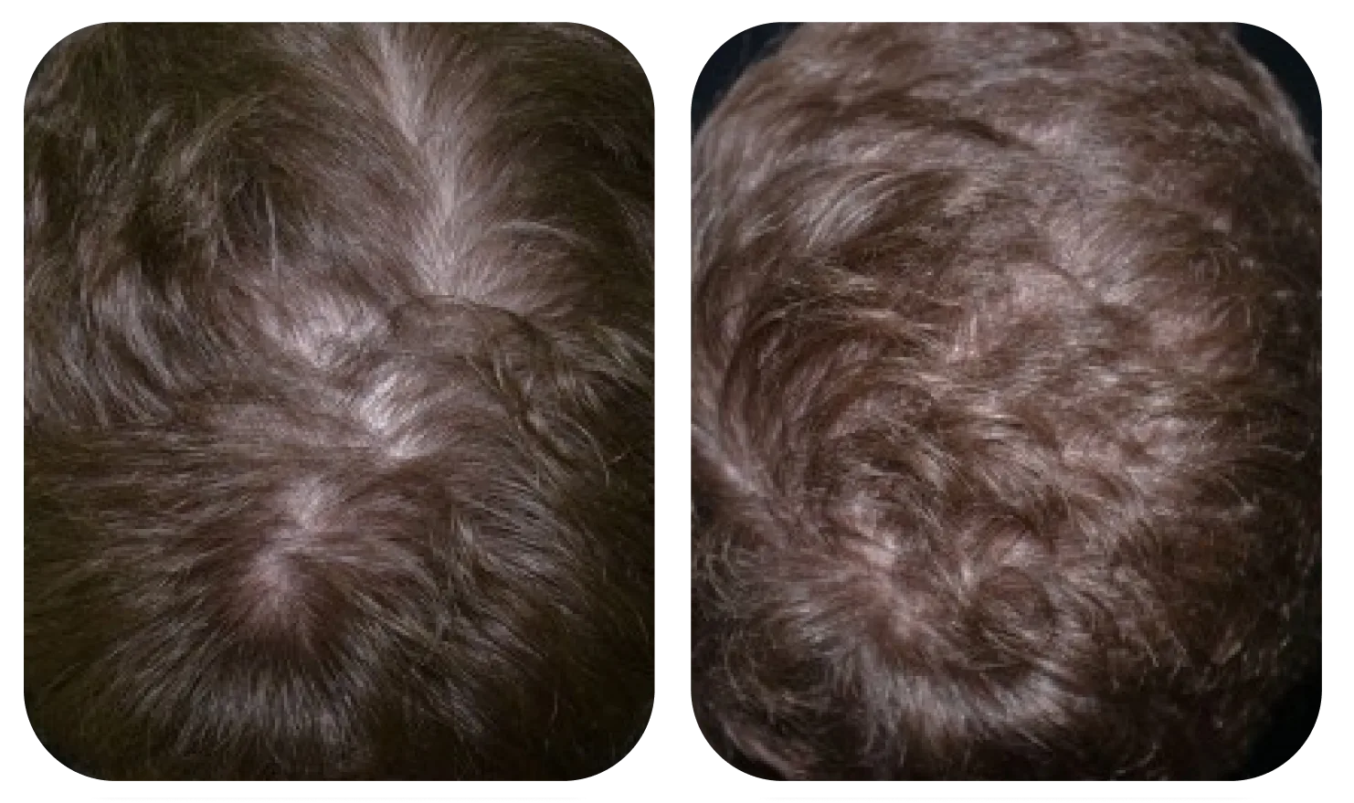 Da đầu trước và sau khi dùng AloEx Organic Intensive Hair Serum, ảnh 4