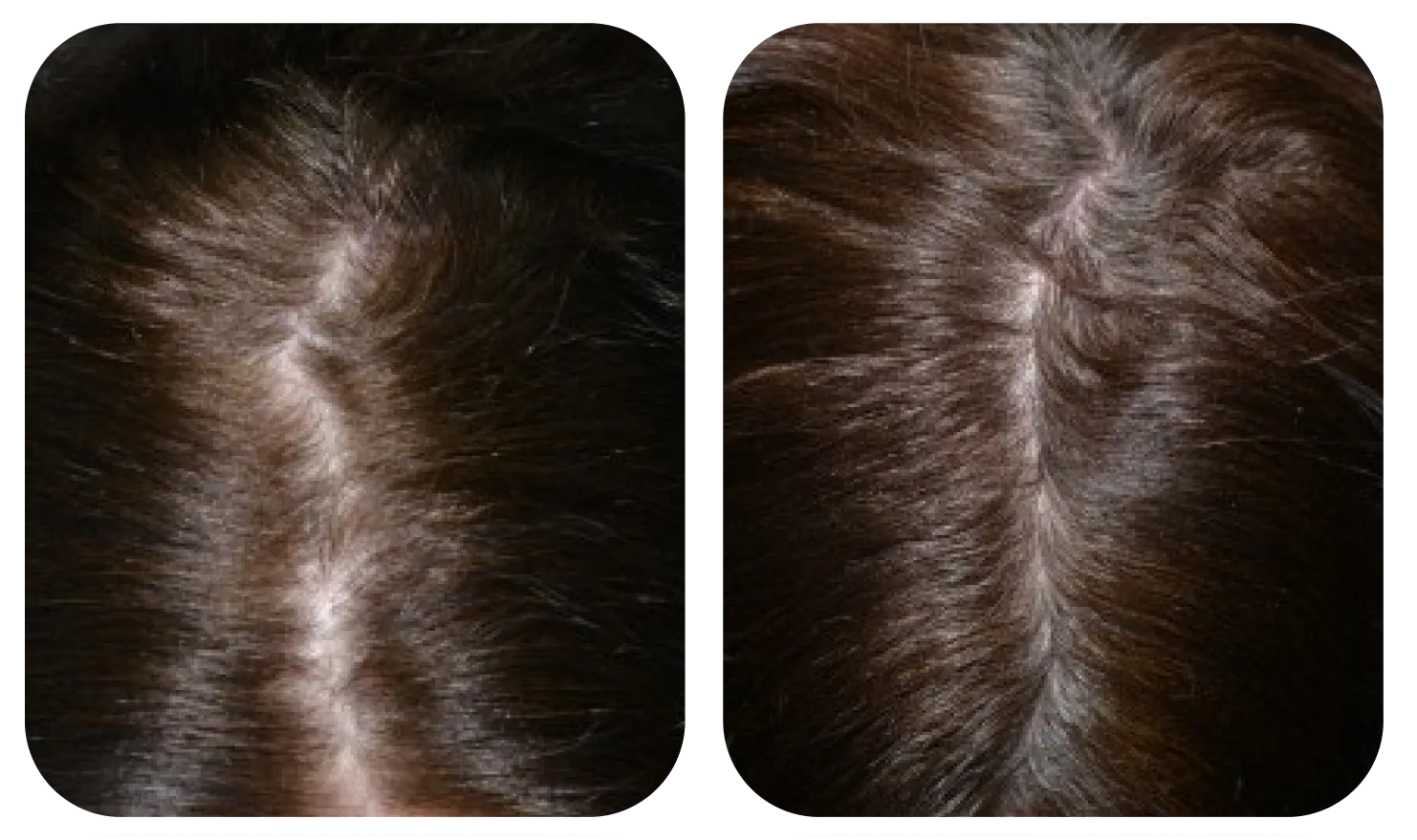 Da đầu trước và sau khi dùng AloEx Organic Intensive Hair Serum, ảnh 5