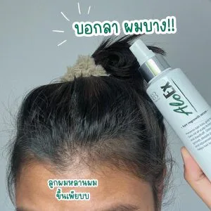 บอกลาวงการ กระหม่อมบาง เลิกเป็นสาวผมร่วงแล้วเด้อ !! แคทว่ามันเริส