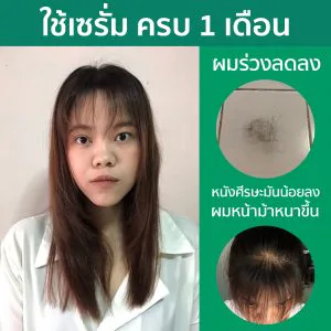 ဆံပင်ကျွတ်ခြင်း ဖြေရှင်းပြီး ဆံပင်အဆီ လျှော့ချပေးတဲ့ ဆီးရမ်လေး ရောက်လာပါပြီရှင်။