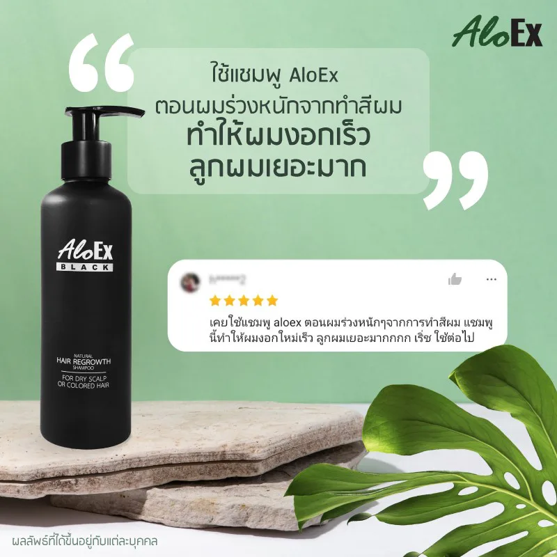 ဆေးဆိုးခြင်းကြောင့် ဆံပင်ပြင်းထန်စွာကျွတ်နေချိန် AloEx ရှန်ပူသုံးခဲ့သည် â€” ဆံပင်ပိုမြန်မြန်ပြန်ပေါက်လာ၊ အသစ်အများကြီးပေါက်
