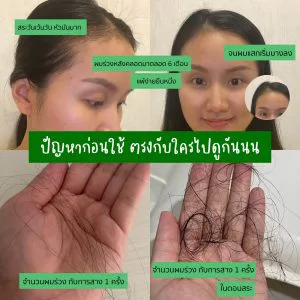 မွေးပြီးစ မိခင်တွေနဲ့ ဖျက်လွယ်သူတွေအတွက် ဆံပင်ကျွတ်ခြင်း ဖြေရှင်းတဲ့ ခေါင်းလျှော်ရည် AloEx Extra Mild နဲ့ ပြန်လာတာကို ကြိုဆိုပါတယ်။