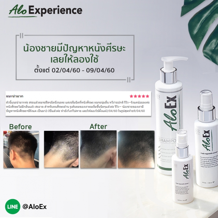 น้องชายมีปัญหาหนังศีรษะเลยให้ลองใช้