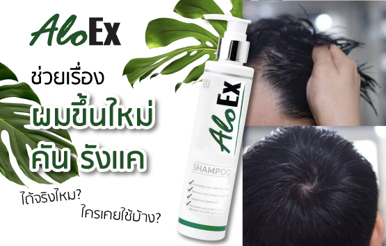 AloEx ช่วยเรื่องผมขึ้นใหม่ คัน รังเเค ได้จริงไหม? ใครเคยใช้บ้าง?