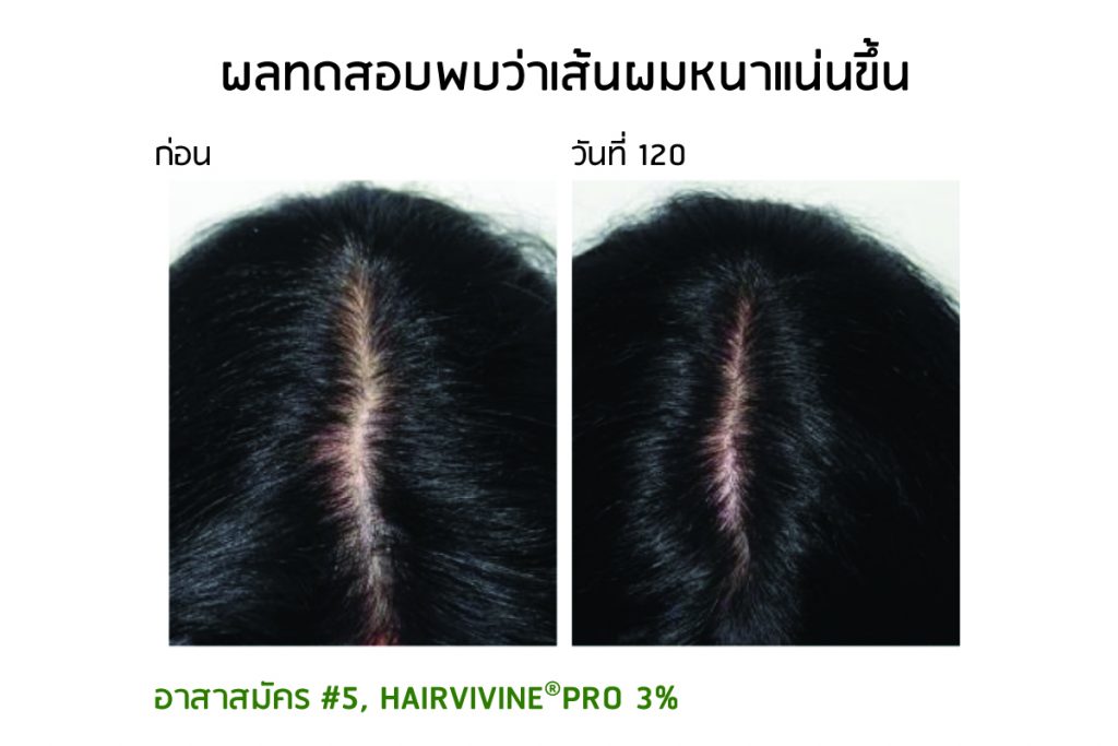 Hairvivine-Pro Clinically tested before after